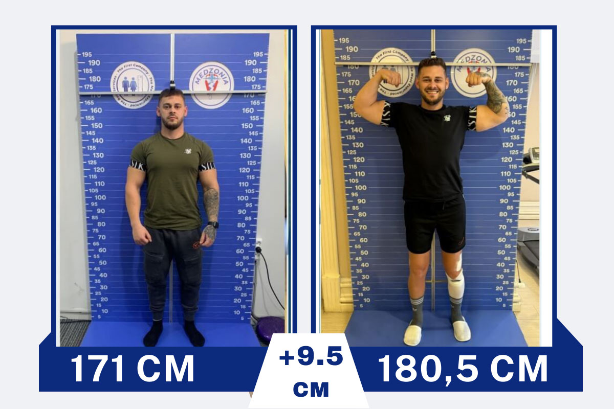 before-after-1-2026-01