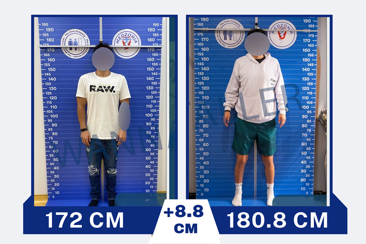 before-after-10-2026-01