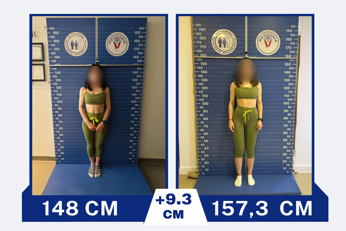 before-after-11-2026-01