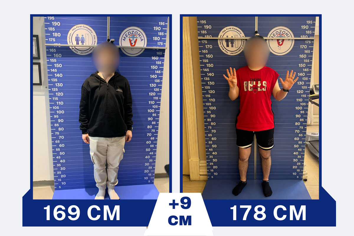 before-after-12-2026-01