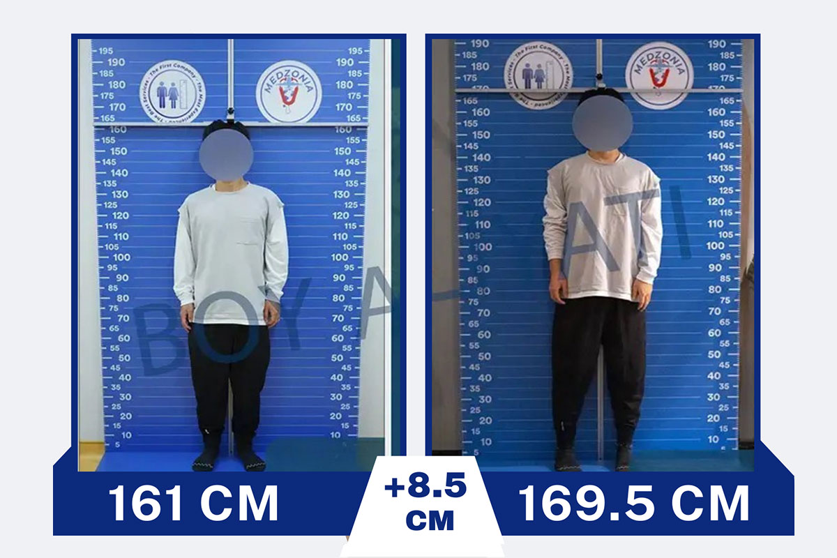 before-after-13-2026-01