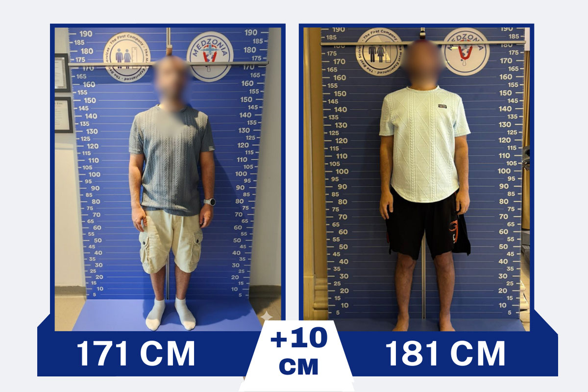 before-after-14-2026-01