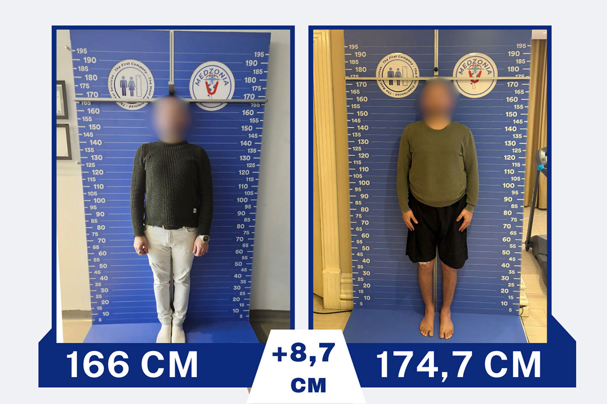before-after-15-2026-01