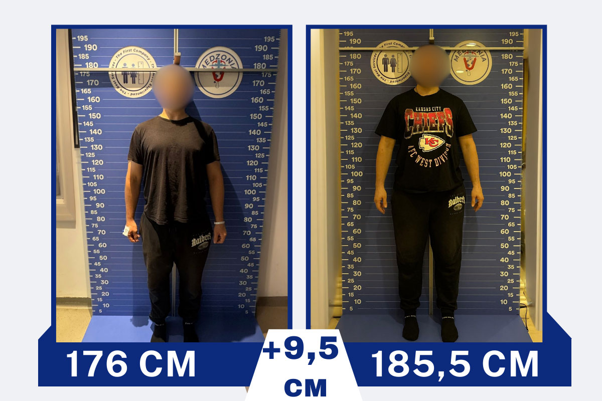 before-after-16-2026-01