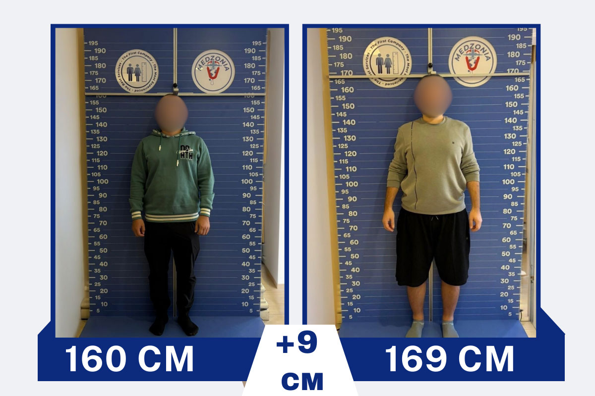 before-after-17-2026-01