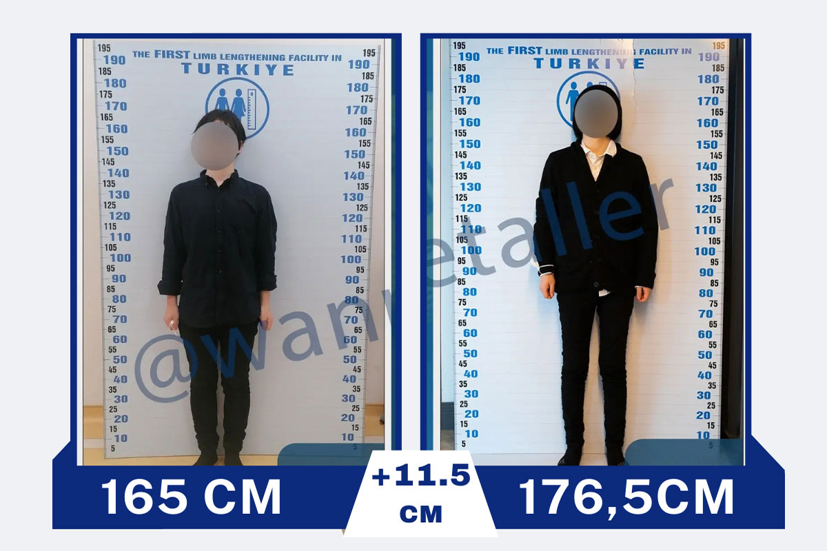 before-after-18-2026-01