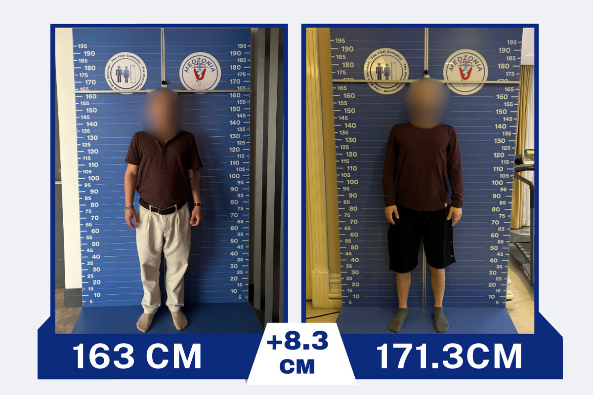 before-after-19-2026-01