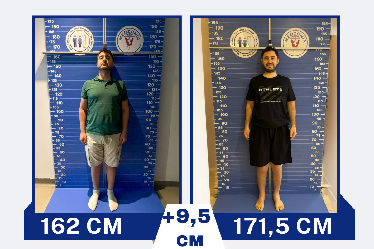 before-after-2-2026-01