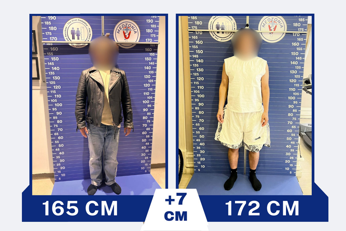 before-after-20-2-2026-01