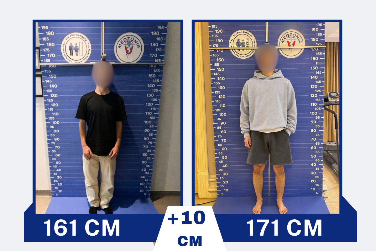before-after-21-2026-01