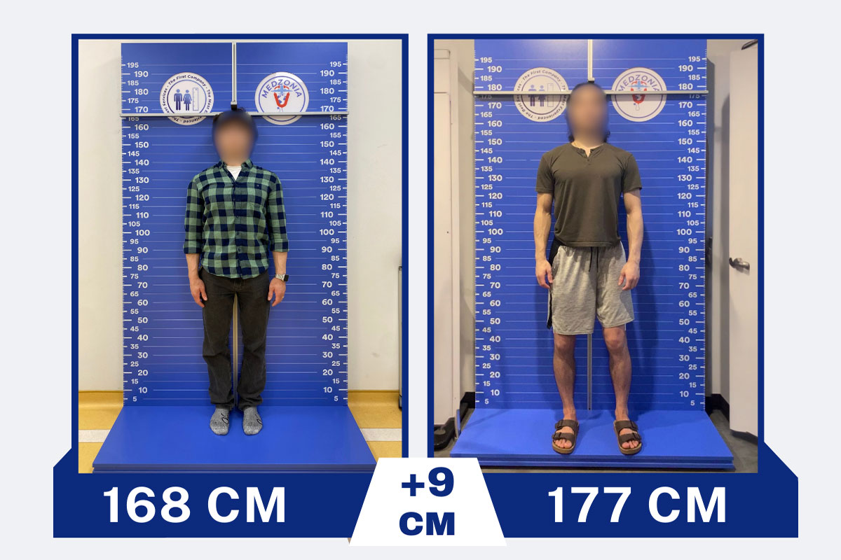 before-after-22-2026-01