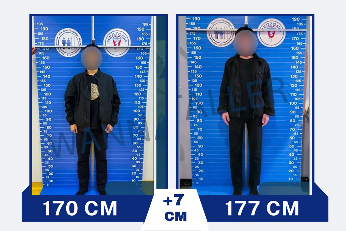 before-after-23-2026-01