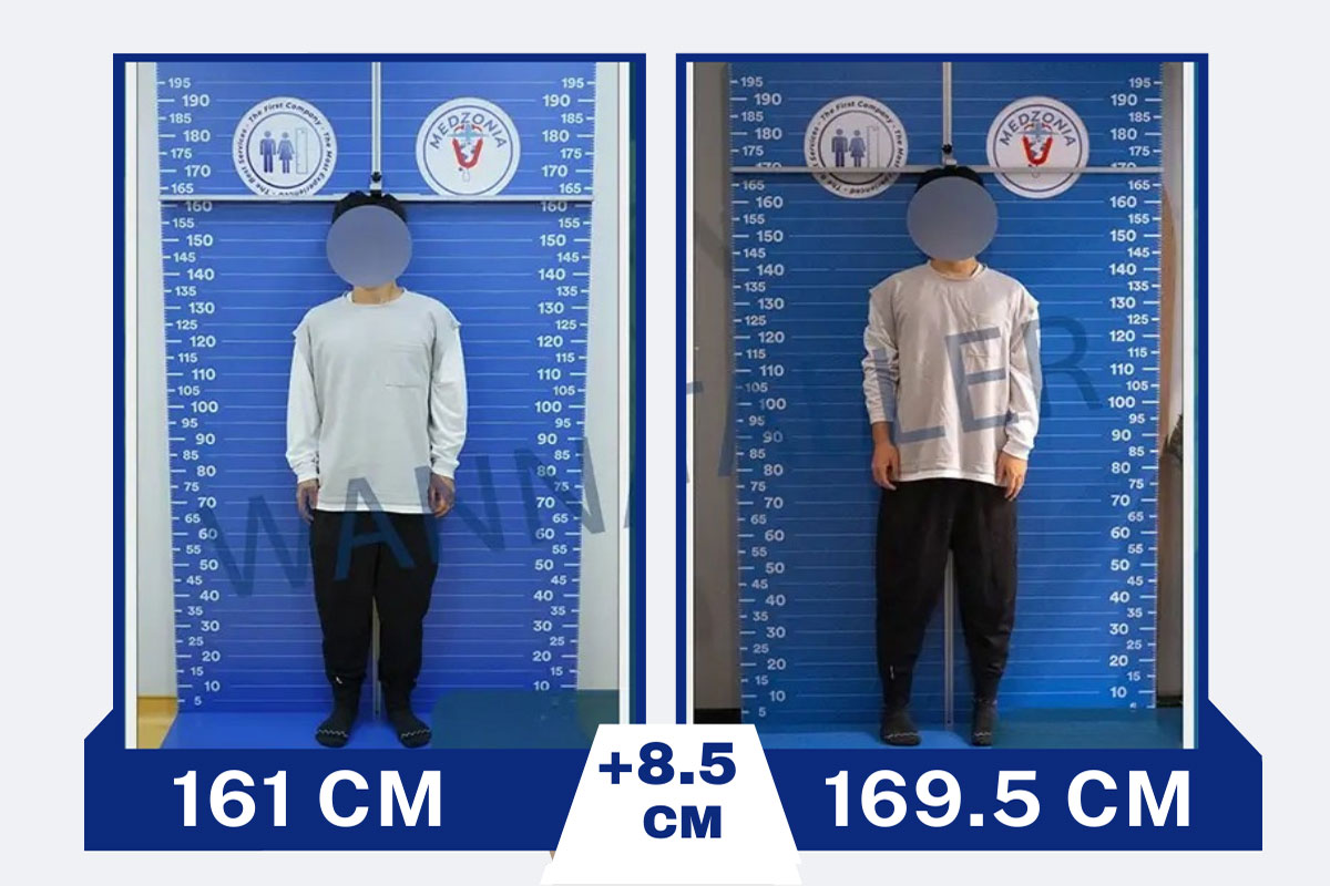 before-after-24-2026-01