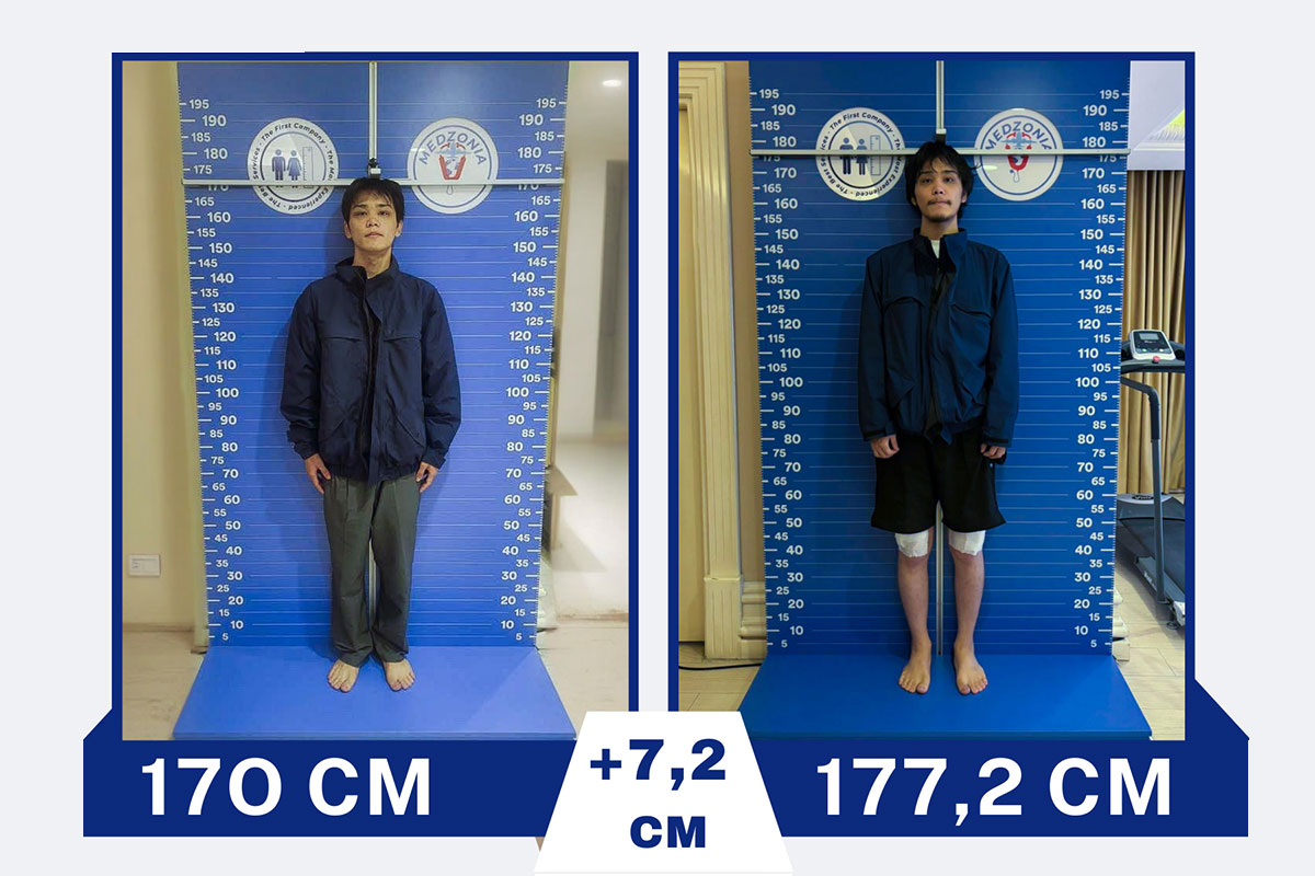 before-after-25-2026-01