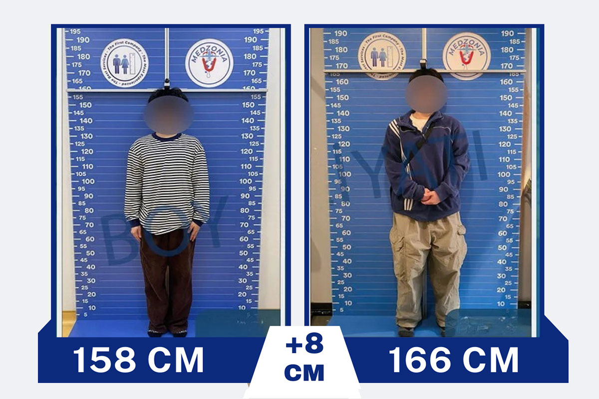 before-after-26-2026-01