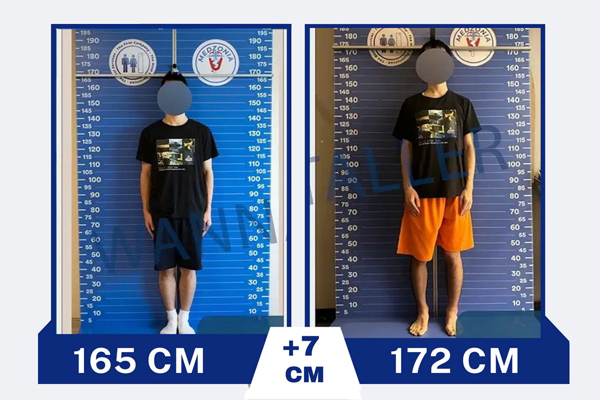 before-after-27-2026-01