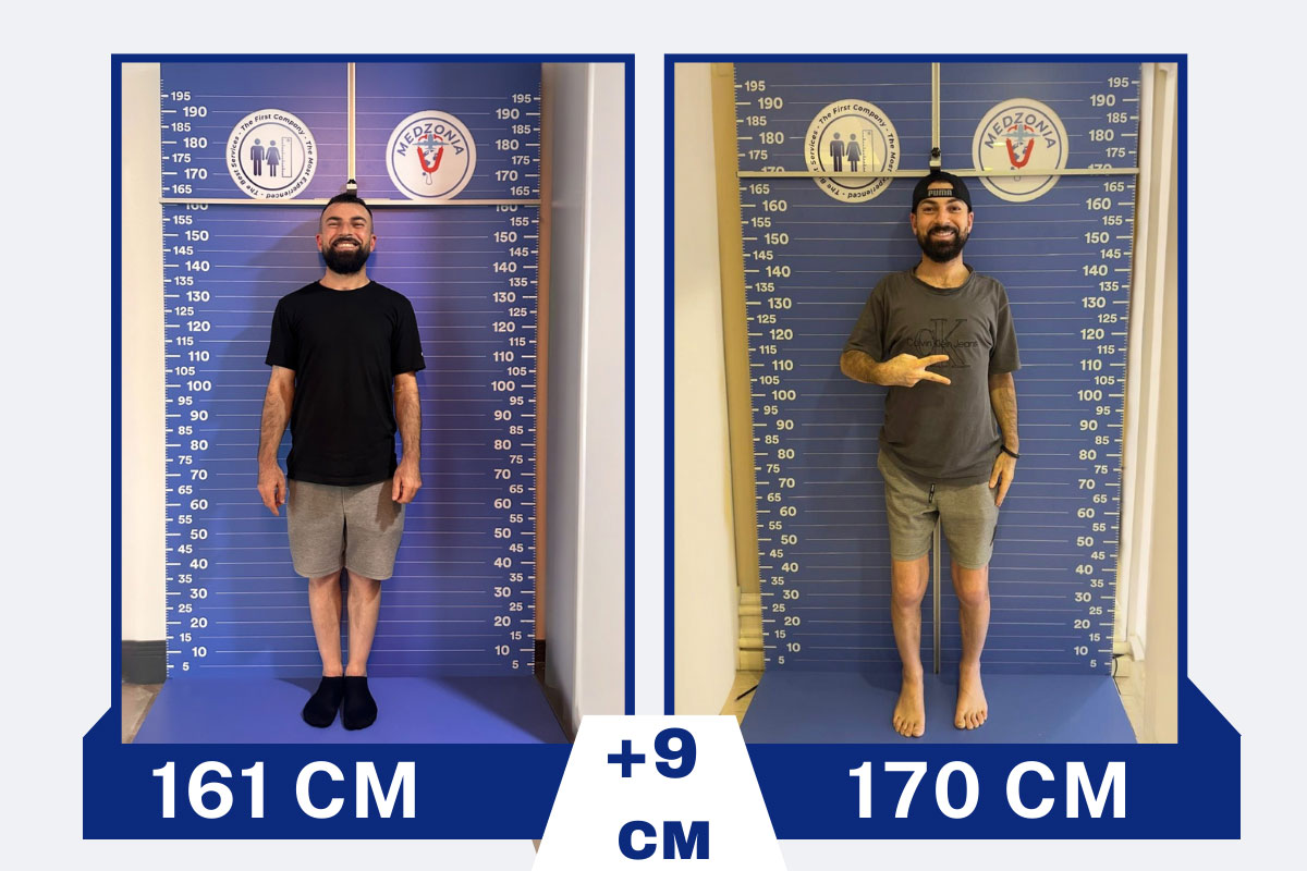 before-after-28-2026-01