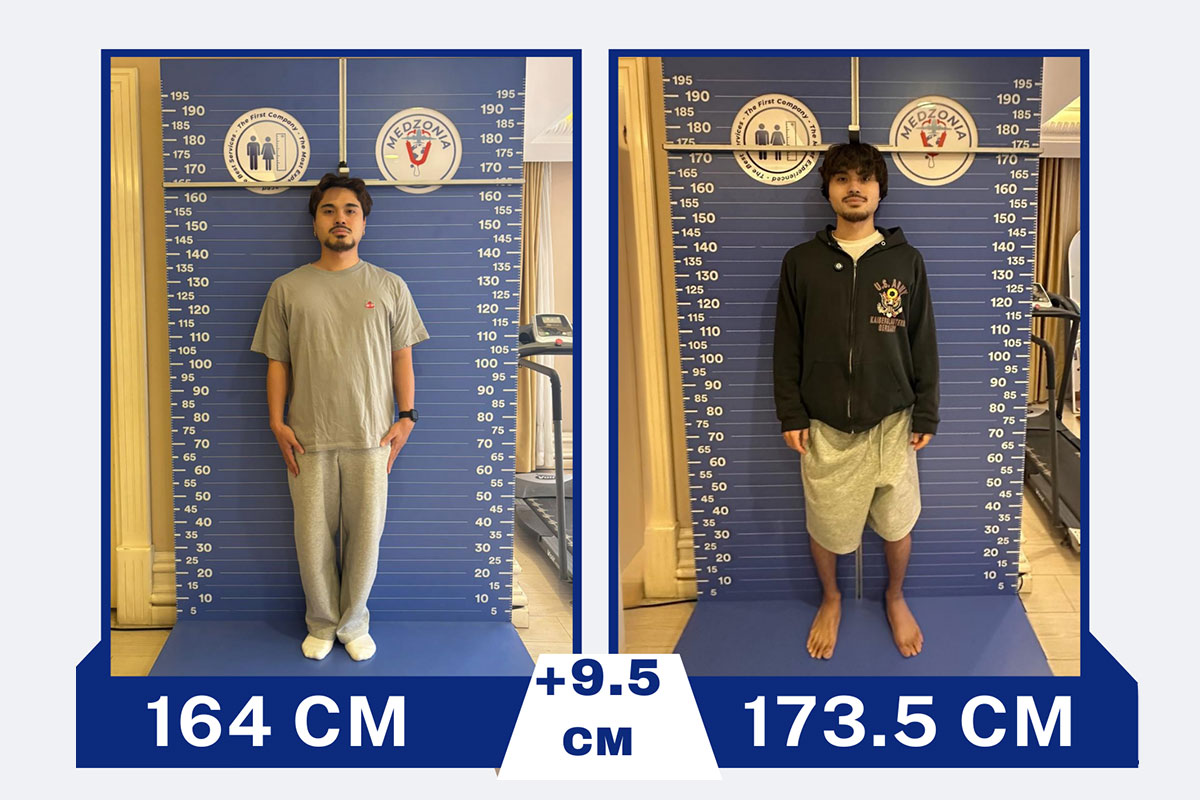 before-after-29-2026-01