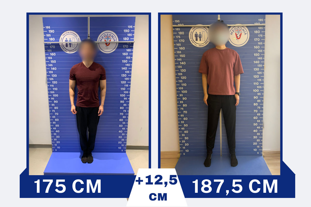 before-after-3-2026-01