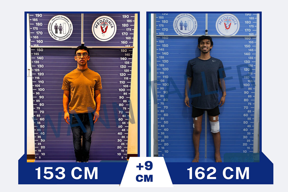 before-after-30-2026-01