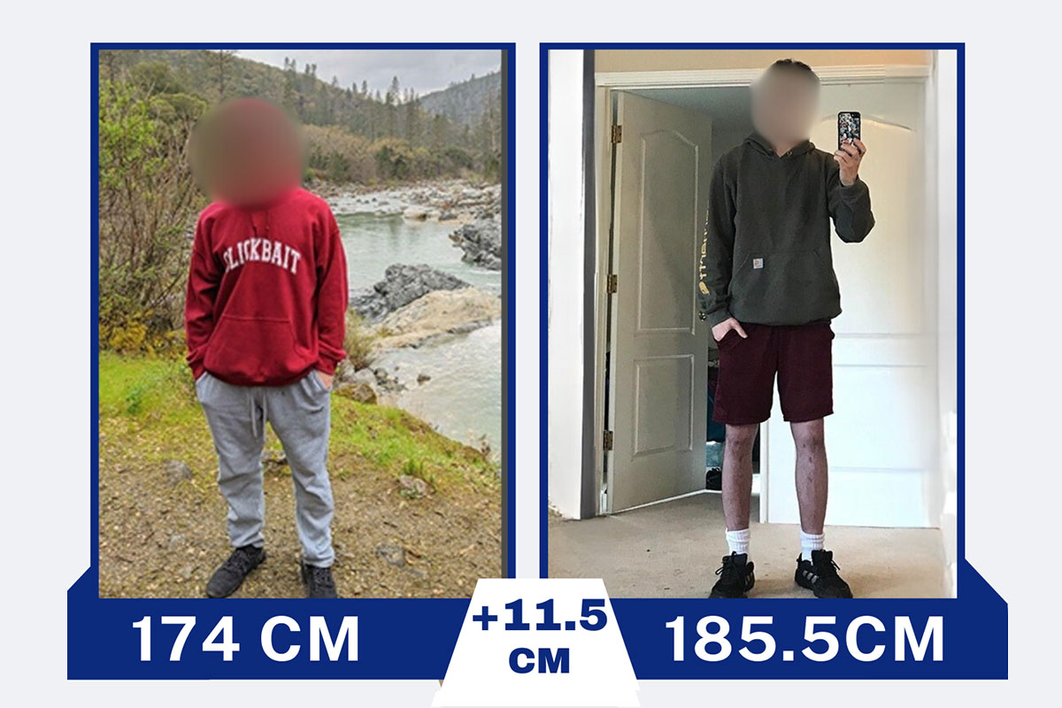 before-after-4-2026-01