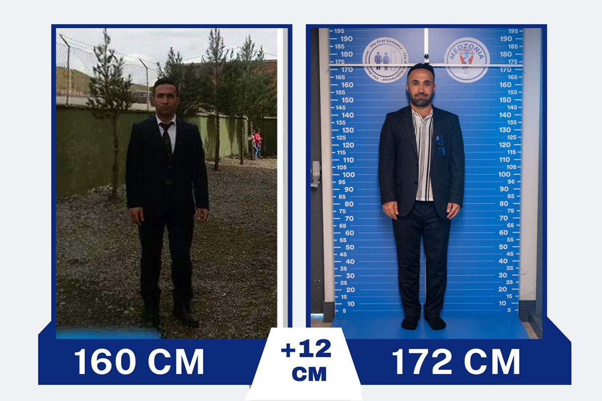 before-after-5-2026-01