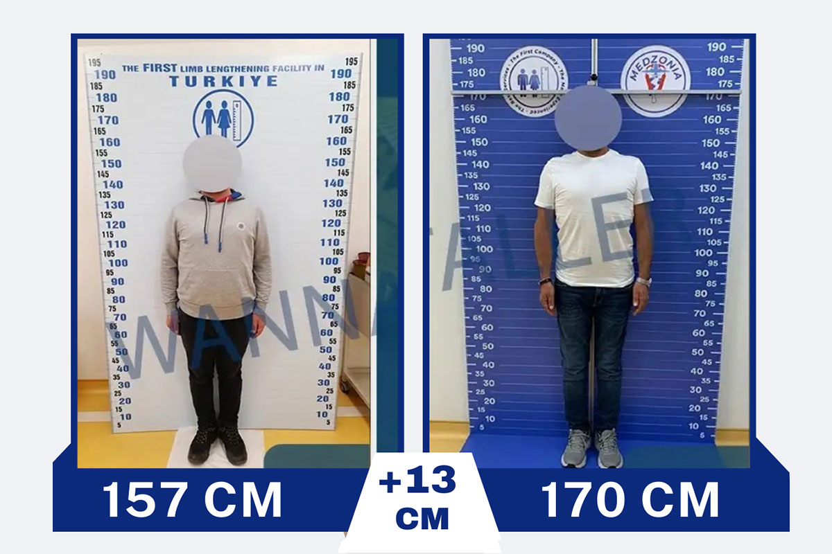 before-after-6-2026-01