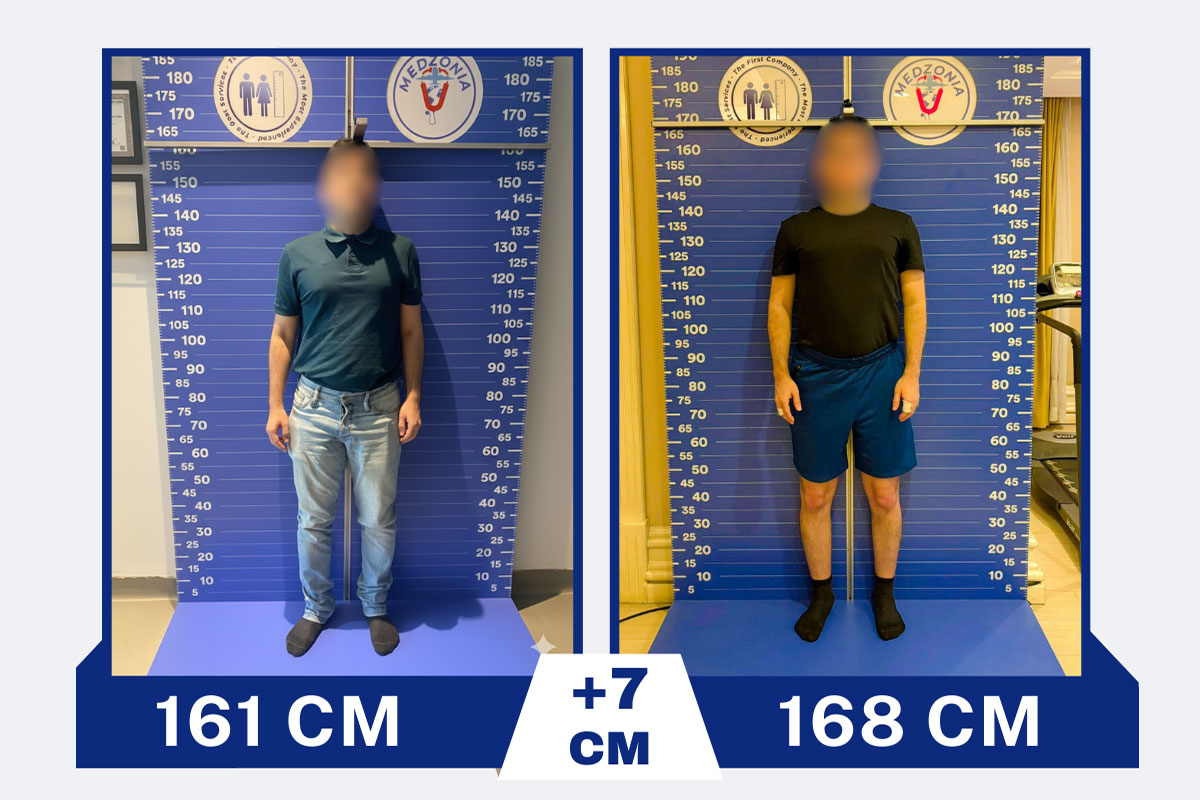 before-after-7-2026-01