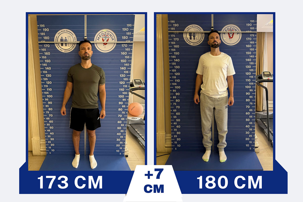 before-after-8-2026-01