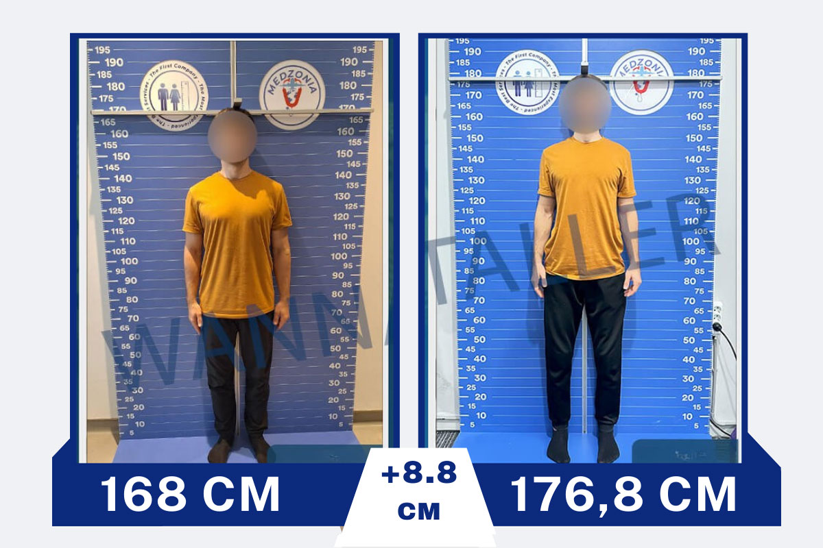 before-after-9-2026-01